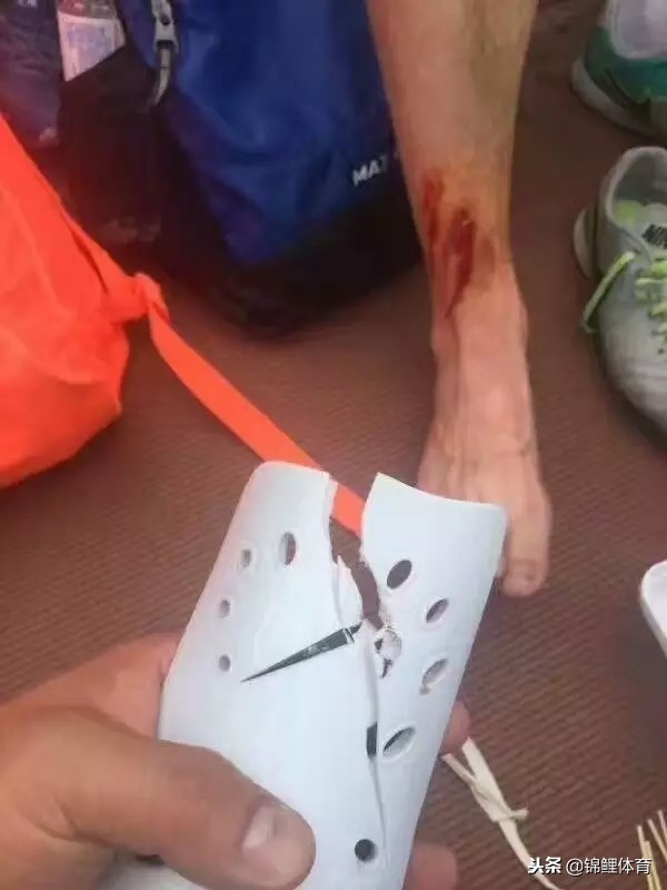 球场最大的暴力事件,球场暴力事件集锦