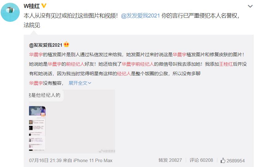 华晨宇澄清植发,华晨宇新闻植发