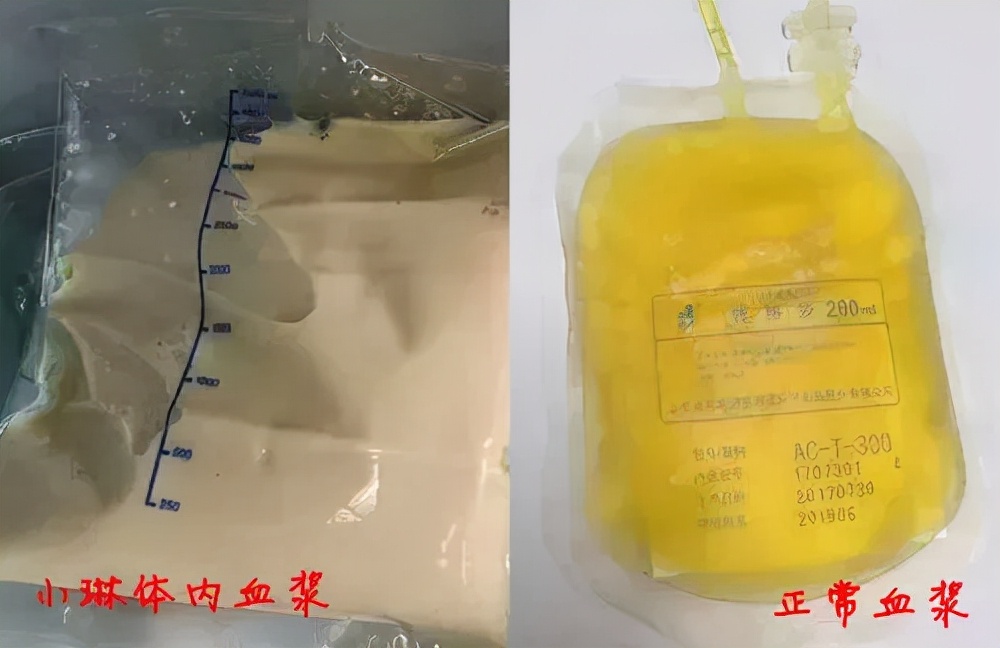 网红炸鸡店被曝光,外卖黑心商家食品曝光