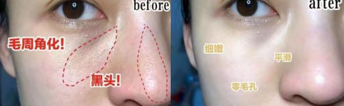 张韶涵新西兰化妆品,张韶涵美妆品推荐