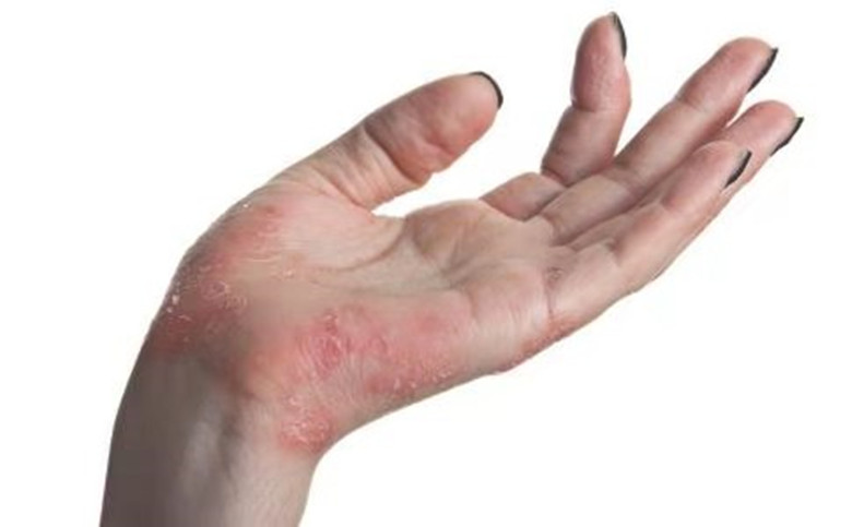 我和虫子大战完整版,我与昆虫的对决