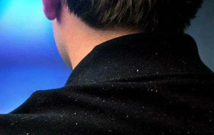 梦禾科普｜如何对付烦人的头皮屑