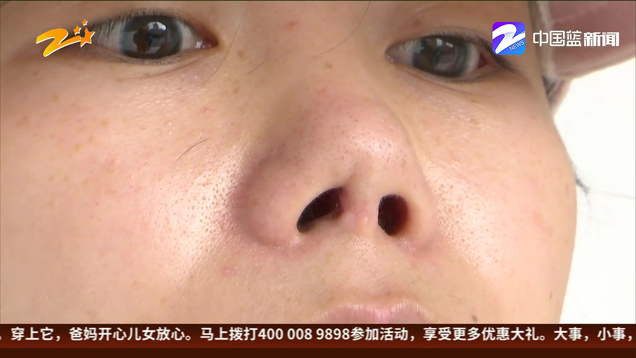 女子做鼻综合手术，莫名其妙鼻子流出黄色液体，这事到底怪医院还是怪她？