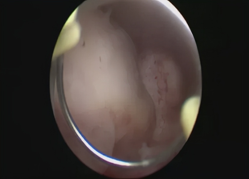 女性做amh检查要注意什么,女性检查必做项目以及时间