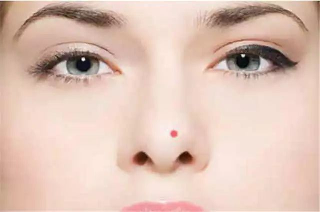 眨眼睛面部肌肉跟着动是什么原因,面部三叉神经痛是什么原因导致的