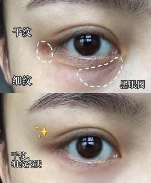 戚薇的眼霜有哪些,戚薇眼霜去细纹吗