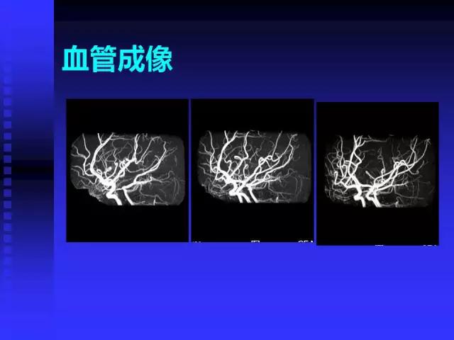 头颅mri读片视频教程,颅脑mri读片入门教程视频讲解全集