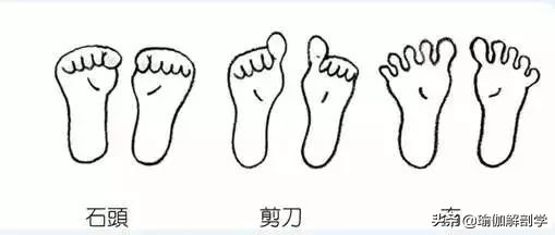 足踝稳定性差应该怎么练,扁平足怎么锻炼脚踝力量