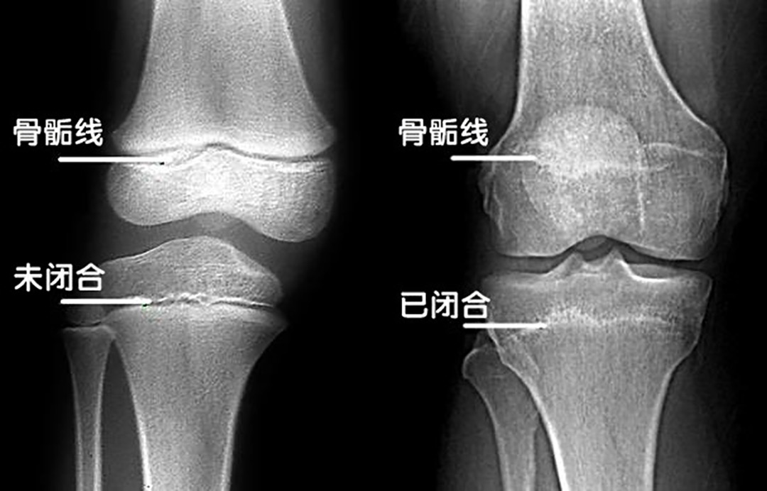 成年人还能通过什么长高,成年人可以通过身体塑形长高吗