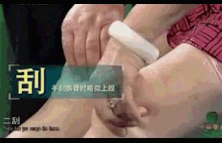 病例：这个患者双膝畸形，无法伸直，活动受限，并有严重骨刺