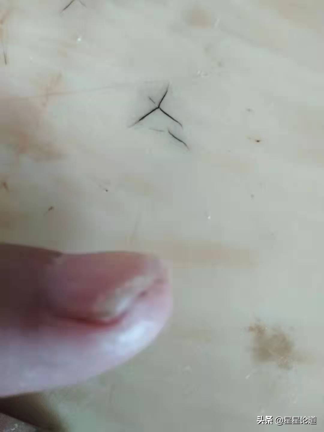 指甲盖划伤修复,指甲盖剪破了怎么办