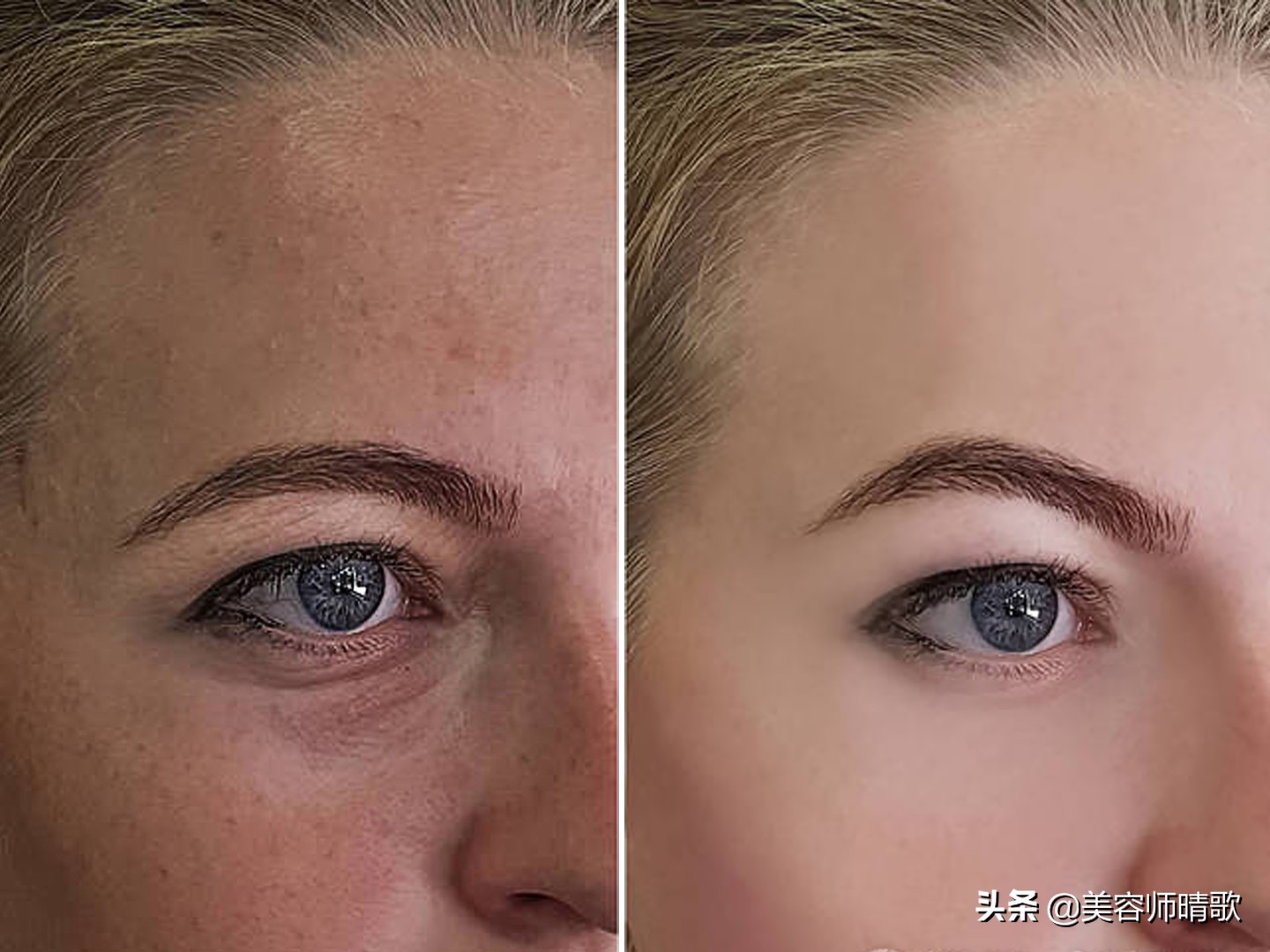 小银瓶淡斑精华推荐,美白淡斑小白瓶精华