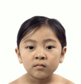 线雕一般多久做一次比较好,线雕多做几次维持的时间会越长吗