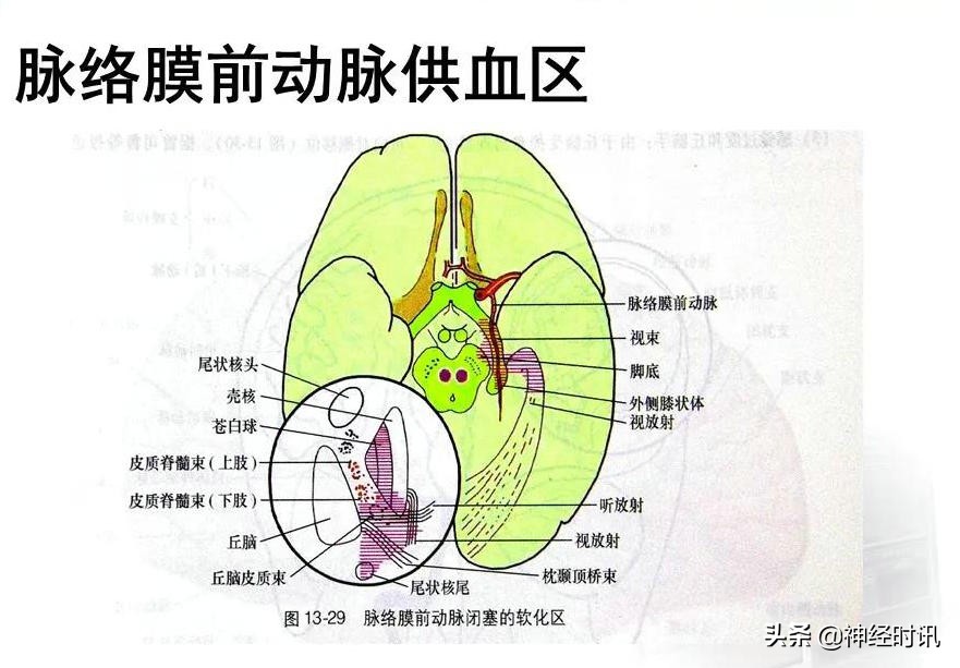 脑动脉解剖学讲解,基底节区脑血管解剖