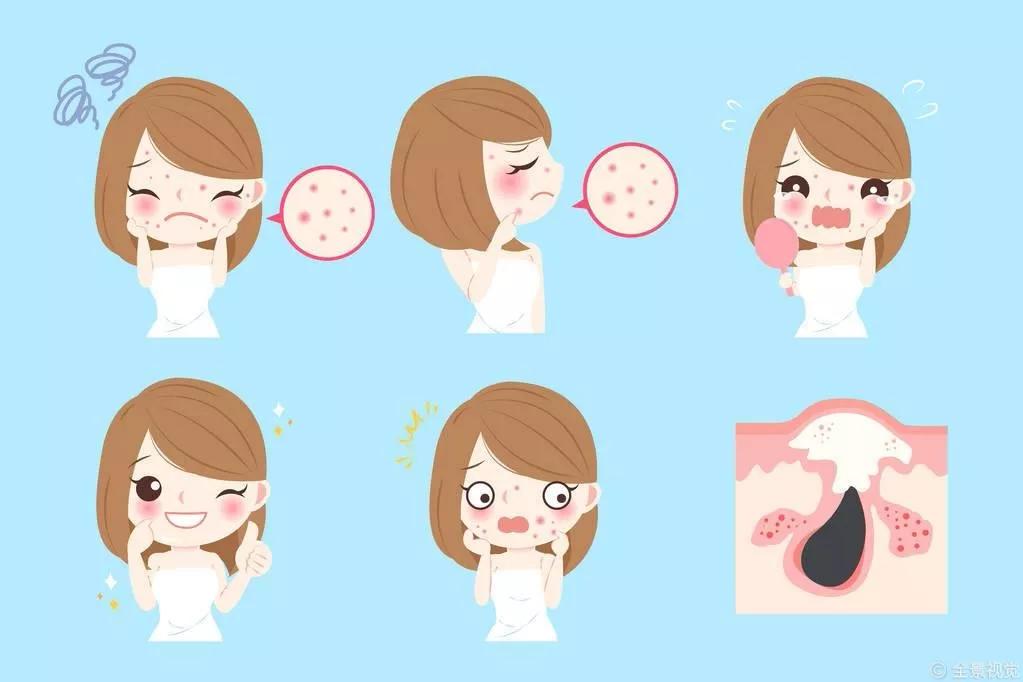 甲硝唑凝胶对哪种痘痘有效,甲硝唑凝胶祛痘痘的正确方法