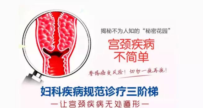 女性tct检查能查出疱疹病毒感染吗,女性tct和hpv只检查一个选哪个