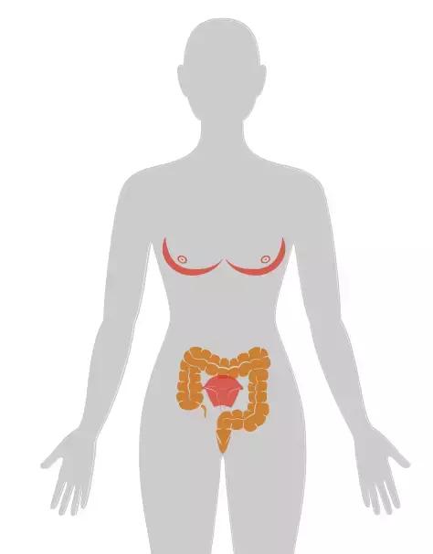 四个早期症状告诉你得了癌症,四种情况你有癌细胞