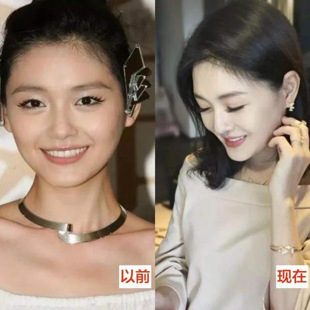 大s打的美白针是啥牌子,大s美白针品牌