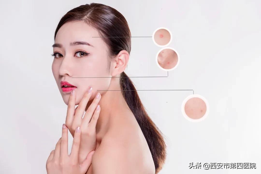 什么样的医美能让毛孔变小,收缩毛孔什么医美项目最有效