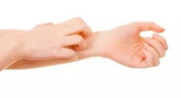 医生有阴虱是怎么回事,男性下身有虫子不治可以吗