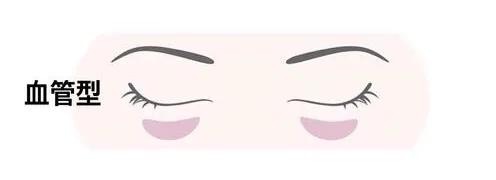 黑眼圈越来越重怎么搞定黑眼圈,简单有效缓解黑眼圈的两个小方法