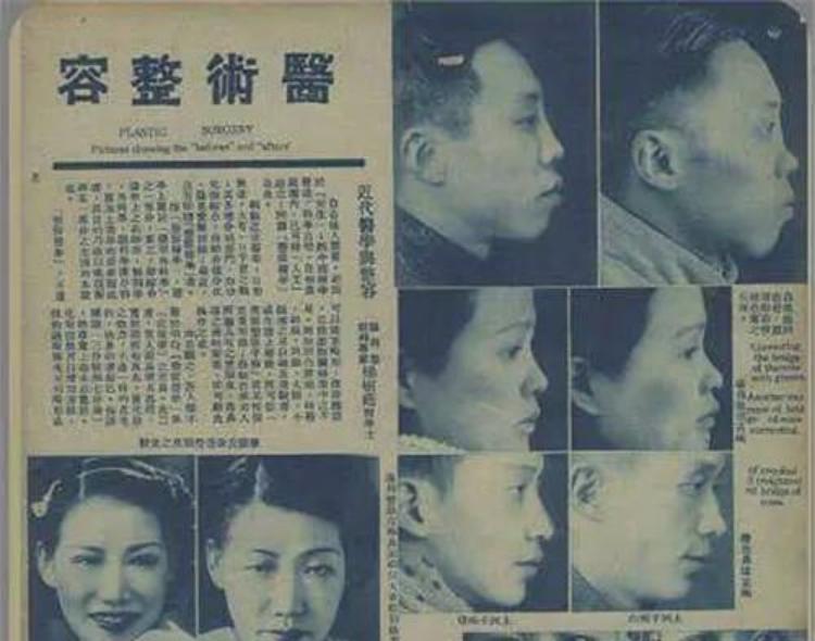 世界第一例整容手术如何诞生的,世界上最早出现的整形医院
