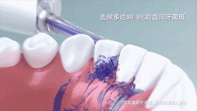 牙齿矫正，你后悔了吗？