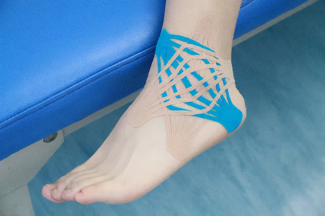 弹性贴布的原理,弹性贴布的作用