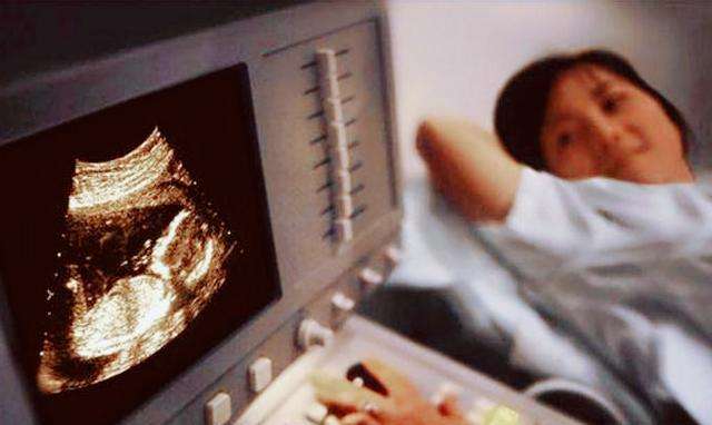 孕检正常生出来是个畸形儿,老婆产检正常却生出畸形儿