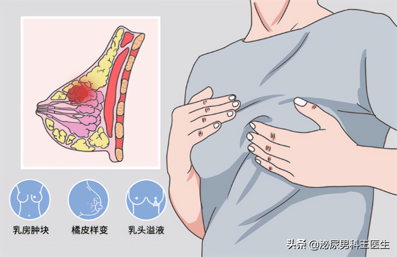 女人绝经后，必须要补充雌激素吗？