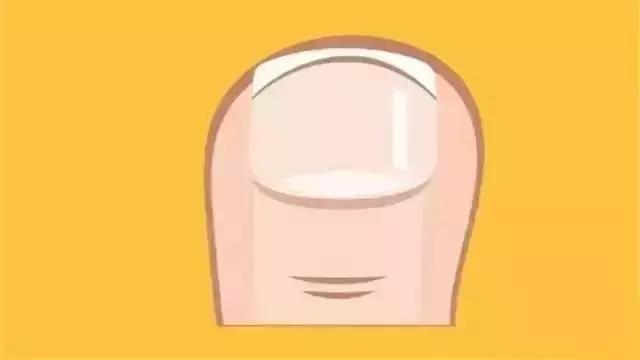 如何取出脚趾甲长进肉里,脚趾甲长进肉里需要拔甲吗