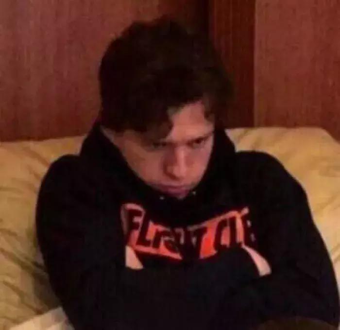 痘印反反复复怎么办,痘印一直反反复复怎么办