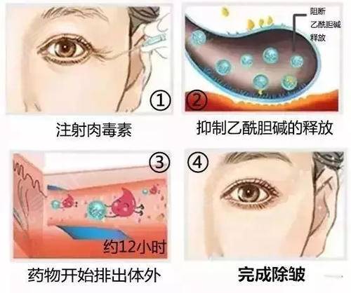 面部衰老改善最好的方法,衰老与面部轮廓的变化