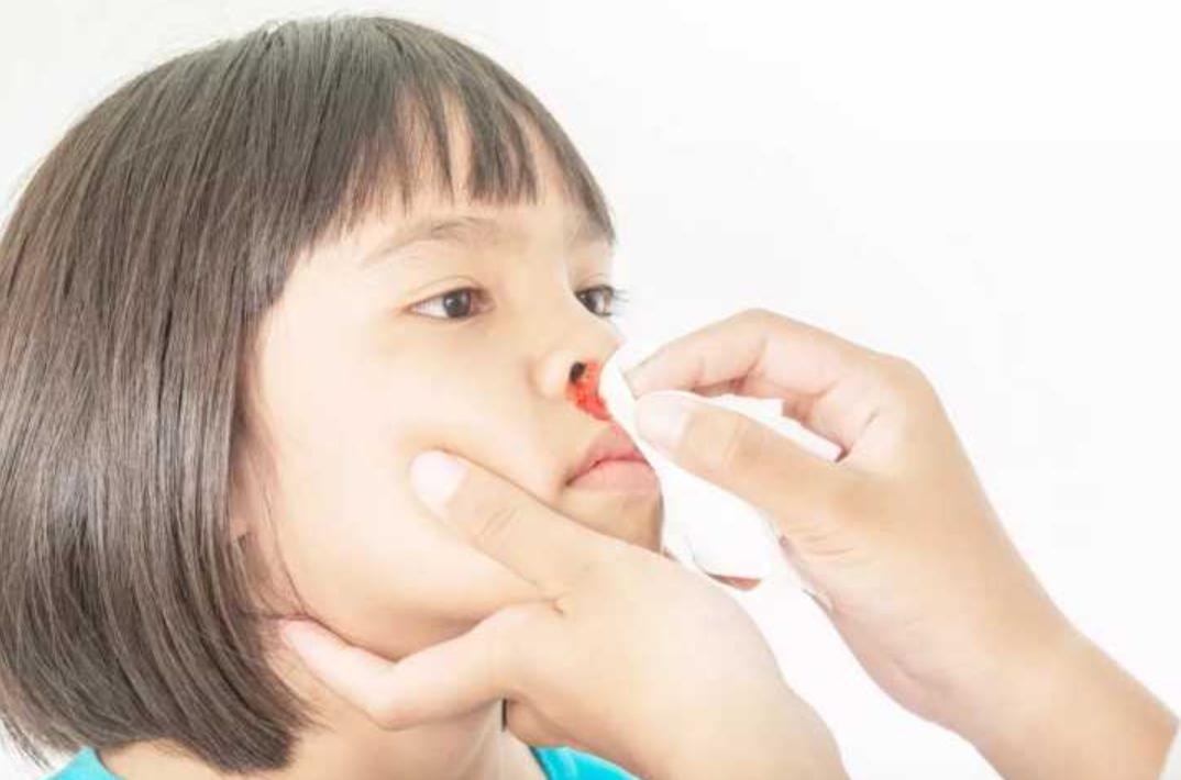 四岁男童夜里鼻子流血都干了,四岁男童左边鼻子出血