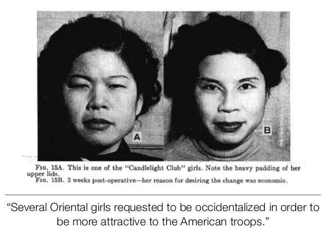 双眼皮是不是中国审美,双眼皮是不是有欧美血统