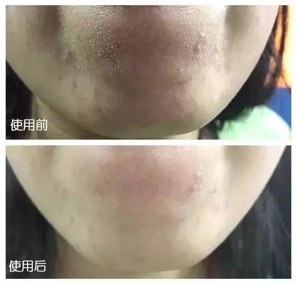 倪妮公认的高级脸照片,倪妮高级脸还可以撑多久