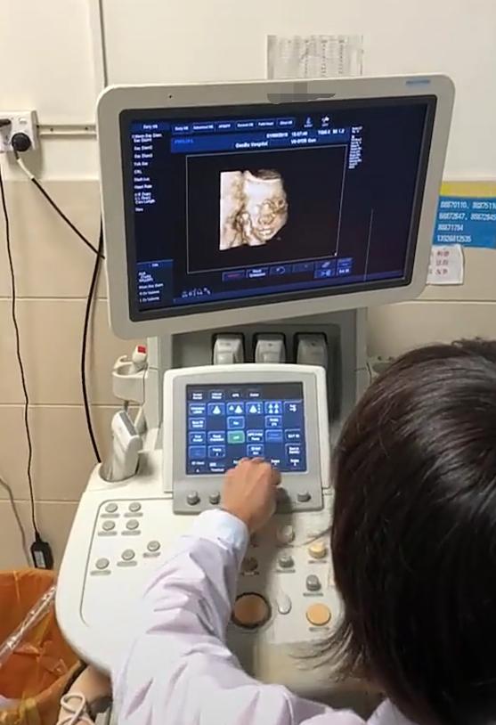 B超检查是男宝，宝爸盼女儿希望翻盘，为啥医生说有点困难？懂了