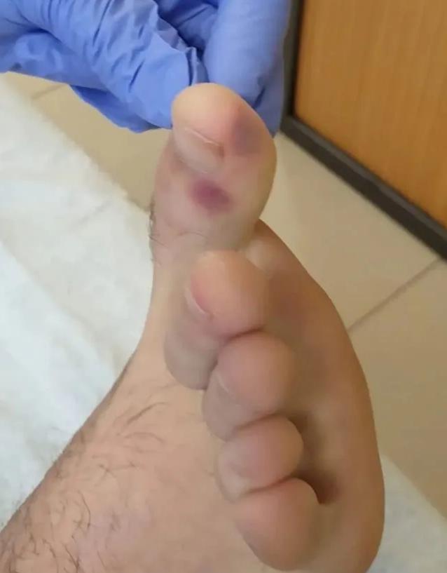 哪些国家有儿童感染新冠病毒的,现在新冠病毒儿童最新症状