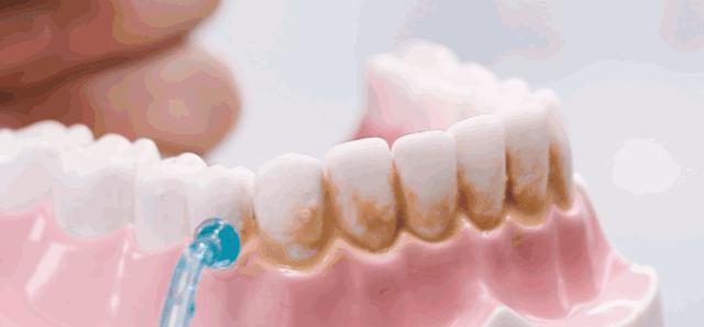 年轻人想要拒绝口臭，就该从饭后b-box开始练起