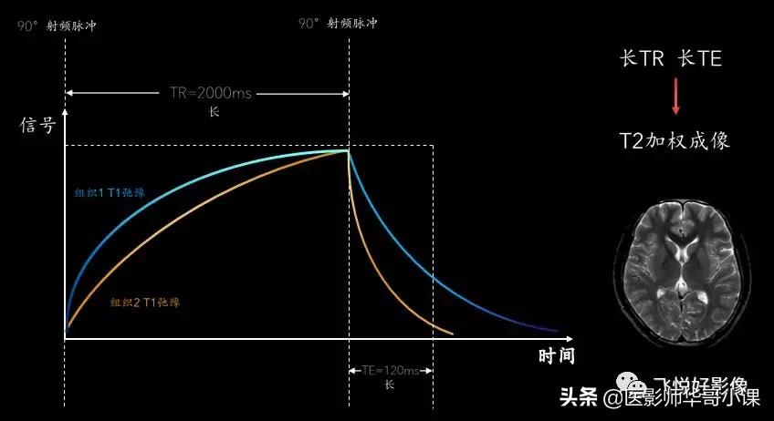 飞利浦磁共振图像操作,飞利浦磁共振成像序列及应用