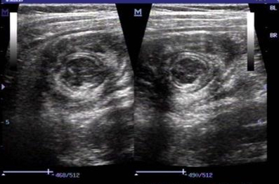 小孩半夜无缘无故哭闹怎么缓解,小孩突然晚上哭闹是什么原因