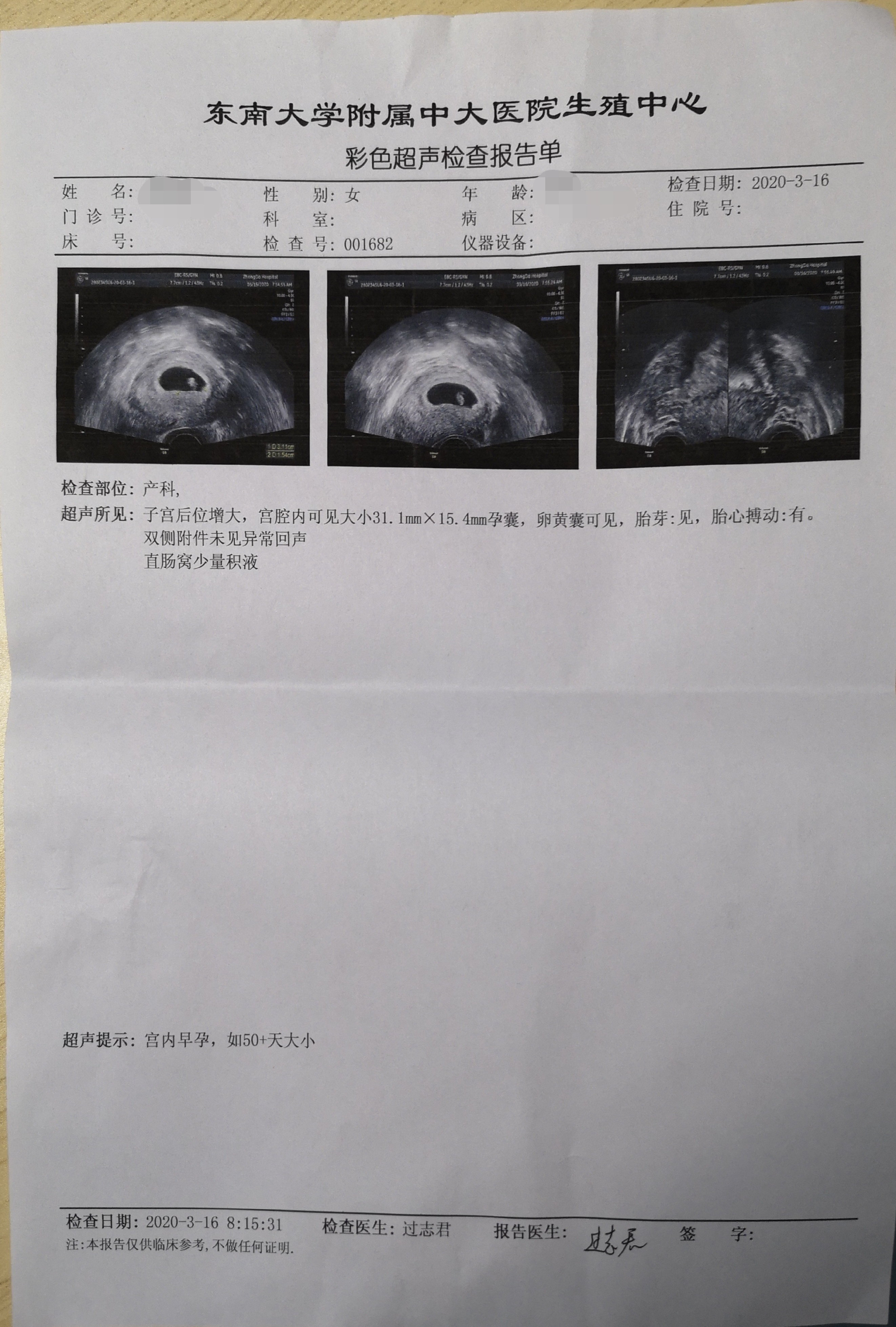 关于排卵障碍型不孕的知识,排卵障碍不孕