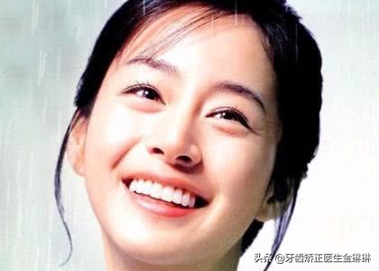 钢牙套矫正的全过程,牙齿稀疏矫正适合隐形还是钢牙套