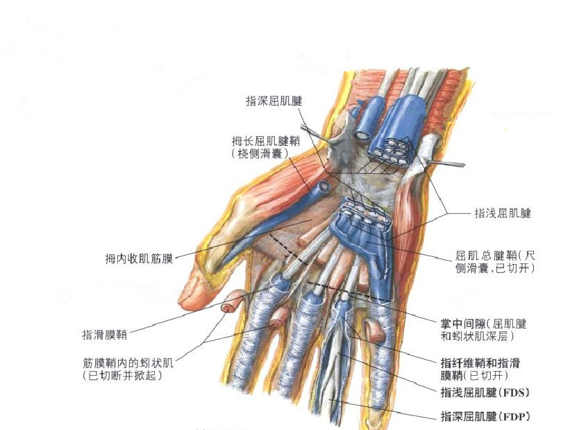 拇指屈肌腱狭窄性腱鞘炎,手指狭窄性腱鞘炎怎么治