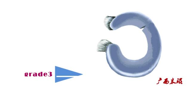 听骨科医生讲的话,听完骨科专家的一段话