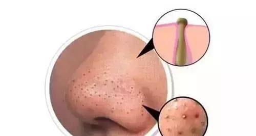 盐洗脸的正确方法让你快速美白,洗脸把脸放水盆里