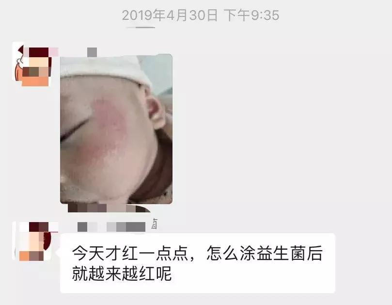 我潜入益生菌微商群1周，发现了包治百病的秘方