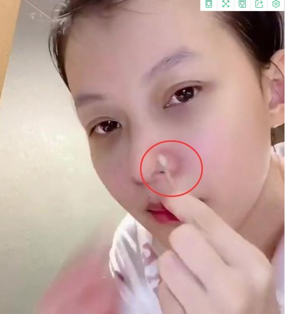 真正好用的去黑头方法,比较方便的去黑头的方法