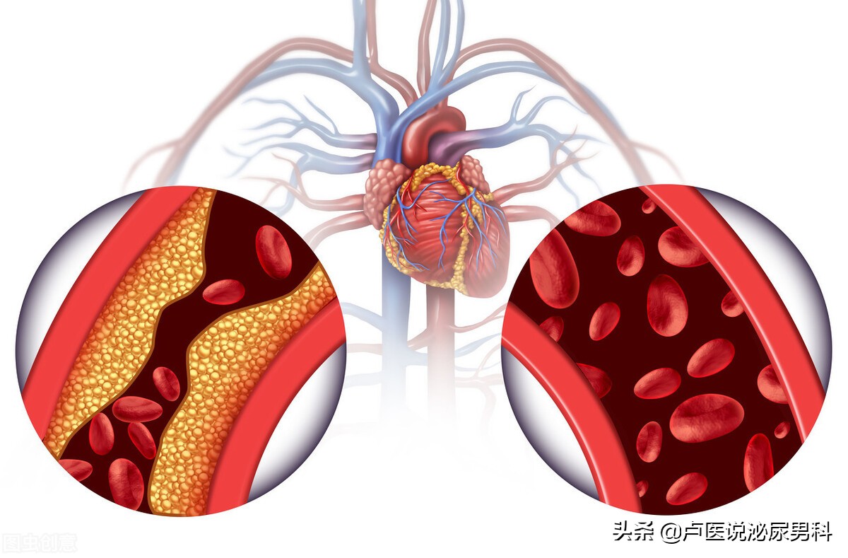 叶酸对心血管疾病的治疗作用,男人补充叶酸预防高血压