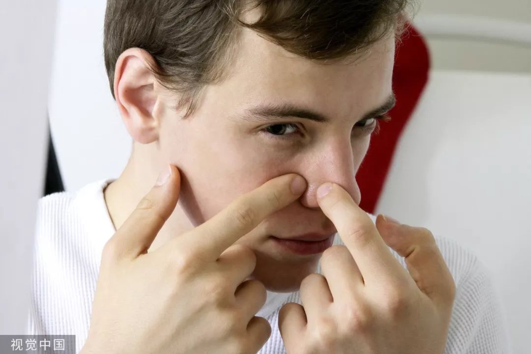 鼻子上用力挤挤出来白色东西很臭,鼻子里面有小鼓包挤出来白色很臭